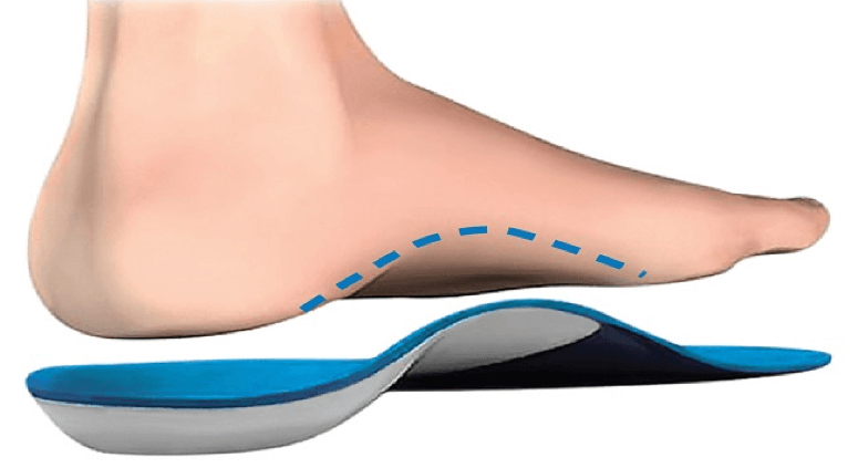 Arch support Arch support